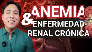 Anemia en Enfermedad Renal Crónica Todo lo que necesitas saber para mejorar tu salud [upl. by Amapuna751]