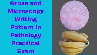 Writing pattern of Microscopy and Gross features in Pathology Practical Exam Approach to Patho OSPE [upl. by Esertak]