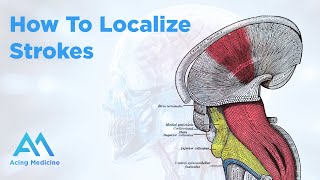 How To Localize Strokes Essential Overview amp Techniques  Acing Medicine [upl. by Ynitsed997]