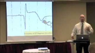 The 6 Causes ST Segment Elevation on an EKG ECG [upl. by Willdon895]