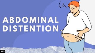 Abdominal Distention Everything You Need To Know [upl. by Messab404]