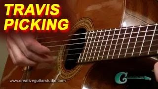 Guitar Lesson Travis Picking [upl. by Abdul302]