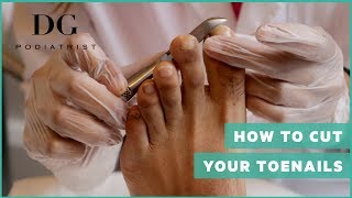 THE FASTEST WAY TO TREAT TOENAIL FUNGUS [upl. by Ro221]