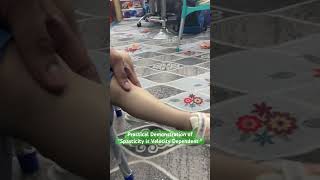 Spasticity is Velocity Dependent  Practical Demonstration [upl. by Cline952]