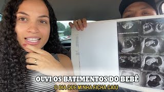 PRIMEIRA ULTRASSONOGRAFIA  OUVIMOS O CORAÇÃO DO BEBE PELA PRIMEIRA VEZ [upl. by Fosque]