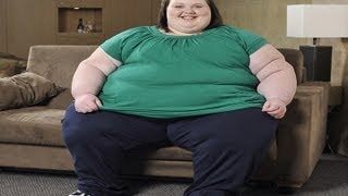 Fattest Teenager In The World  Georgia Davis [upl. by Kataway]