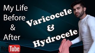 Varicocele treatment  My Story about Varicocele amp Hydrocele after amp before  without surgery amp med [upl. by Weksler]