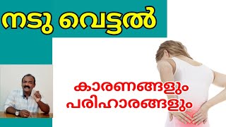 നടു വെട്ടൽ Locked Facet Joint Meniscoid entrapment [upl. by Enelrae]