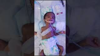 baby care after birth baby youtubeshorts care cute preturm hospital newborn [upl. by Emilio270]