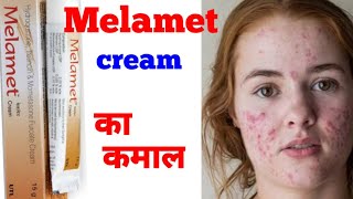 Melamet cream side effects amp Benefits [upl. by Alick]