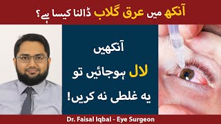 Eye Redness Ka Ilaj  Red Eyes Causes  Red Eye Infection Treatment  Aankhon Ka Laal Ho Jana [upl. by Medarda]