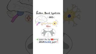 GuillainBarré Syndrome GBS  Part 2…anatomy biology science neuroscience nurse doctor [upl. by Xylina538]