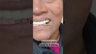 Bestdental treatment bestsmile dentist missingteeth dentalproblem dentalissue phoeniixdental [upl. by Conrad]