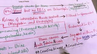 Rhabdomyolysis USMLE Step 1  Renal Pathology [upl. by Attekahs]