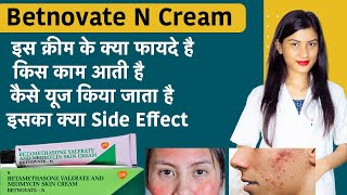 Betamethasone Valerate and Neomycin Skin Cream  Betnovate N Cream for Face  Uses [upl. by Katsuyama]