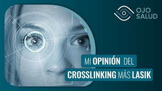 Mi opinión del Crosslinking más Lasik 👨‍⚕️ [upl. by Juliana]