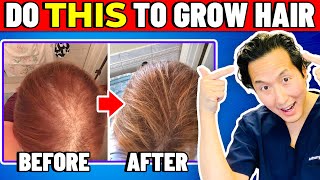 How to Treat Thinning Hair The Holistic Way [upl. by Briano24]