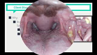 VICE Rounds  Brachycephalic Airway Syndrome See Description For How to Access More Videos [upl. by Gamaliel928]