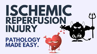 Ischemic Reperfusion Injury Pathology  Explained Simply 2024 [upl. by Potter264]