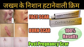 Contractubex Gel review पुराने से पुराने scars Marks को जड़ से मिटा देता है ये जेल।। [upl. by Mitchiner]