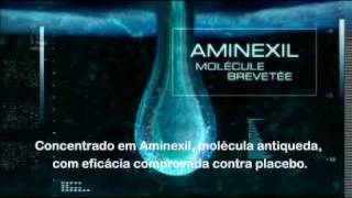 Vichy Aminexil Energy [upl. by Cherilynn]