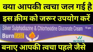 silver sulfadiazine amp chlorhexidine gluconate cream uses in Hindi  born medicine त्वचा जलने की दवा [upl. by Oiramej]