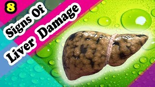 5 Common Signs of Liver Damage [upl. by Trix]