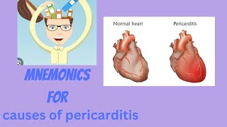 MNEMONICS for causes of pericarditis [upl. by Uzziel]