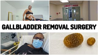 Gallbladder Removal Surgery Vlog  Laparoscopic keyhole Cholecystectomy [upl. by Suirtemid693]