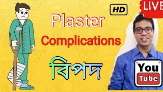 Complication in plaster Plaster এ বিপদ Plaster এ সাবধান Volkmann ischemic contracture [upl. by Rasecoiluj193]