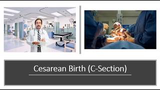 Cesarean Birth CSection [upl. by Prowel]