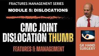 Thumb carpometacarpal joint dislocation CMC joint  Features and management [upl. by Strohl]