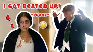 I GoT Beaten Up 🤕🩸PRANK on my BROTHER [upl. by Ydiarf]