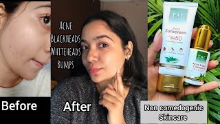 Trying TAC The Ayurveda Co Products sharktank sharktankindia skincare acne [upl. by Anderer]