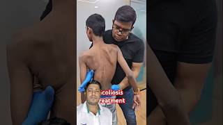 Scoliosis treatment chlorosis chiropractor physiotherapy shoulder motivation chiropractic [upl. by Znieh]