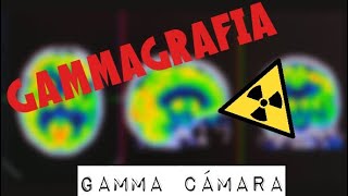 La Gammagrafia [upl. by Ssew]