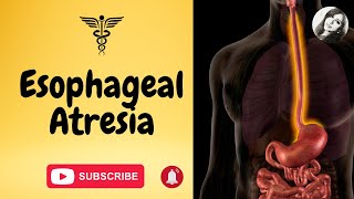 Esophageal atresia amp tracheoesophageal fistula causes types symptoms diagnosis amp treatment [upl. by Annael]