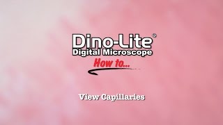 How to View Capillaries using DinoLite USB Microscopes [upl. by Nonna83]