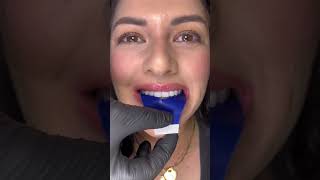 Clean your teeth regularly to check teeth bite strength！ dentist DIYbadbreath 🦷beadrepair [upl. by Vidal304]