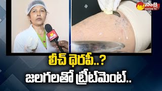 Leech Therapy జలగలతో ట్రీట్‏మెంట్  Dr Vijayalakshmi Explain About Jalaga Treatment  SakshiTV [upl. by Loggia]