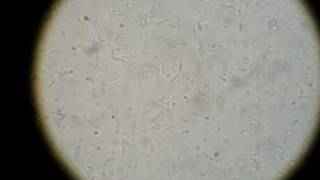 Motile bacteria from culture [upl. by Pirbhai834]