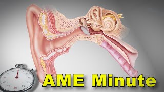 AME Minute Why did the FAA allow AMEs to issue pilots with BPPV [upl. by Nahtaneoj]