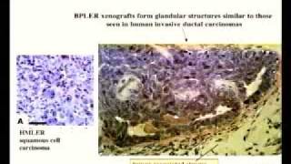 Cancer Stem Cells and Malignant Progression [upl. by Carroll553]