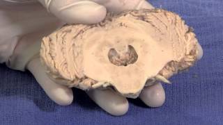 The Cerebellum Neuroanatomy Video Lab  Brain Dissections [upl. by Anailuj]