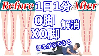 【O脚・XO脚】1日1分！寝ながら膝の捻れを治す方法 [upl. by Juliano894]