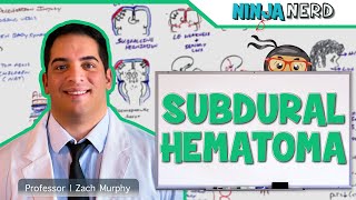 Subdural Hematoma  Anatomy Etiology Pathophysiology Clinical Features Treatment [upl. by Allred848]