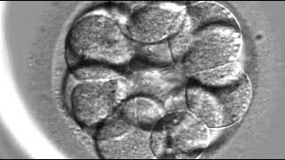 Embryoscope timelapse [upl. by Egon]