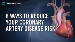 8 Ways to Reduce Your Coronary Artery Disease Risk [upl. by Aslin509]