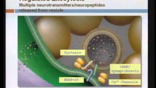 Spasticity Management [upl. by Spanjian]