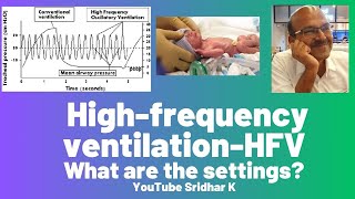 High frequency ventilation l Settings on HFV [upl. by Suhail]